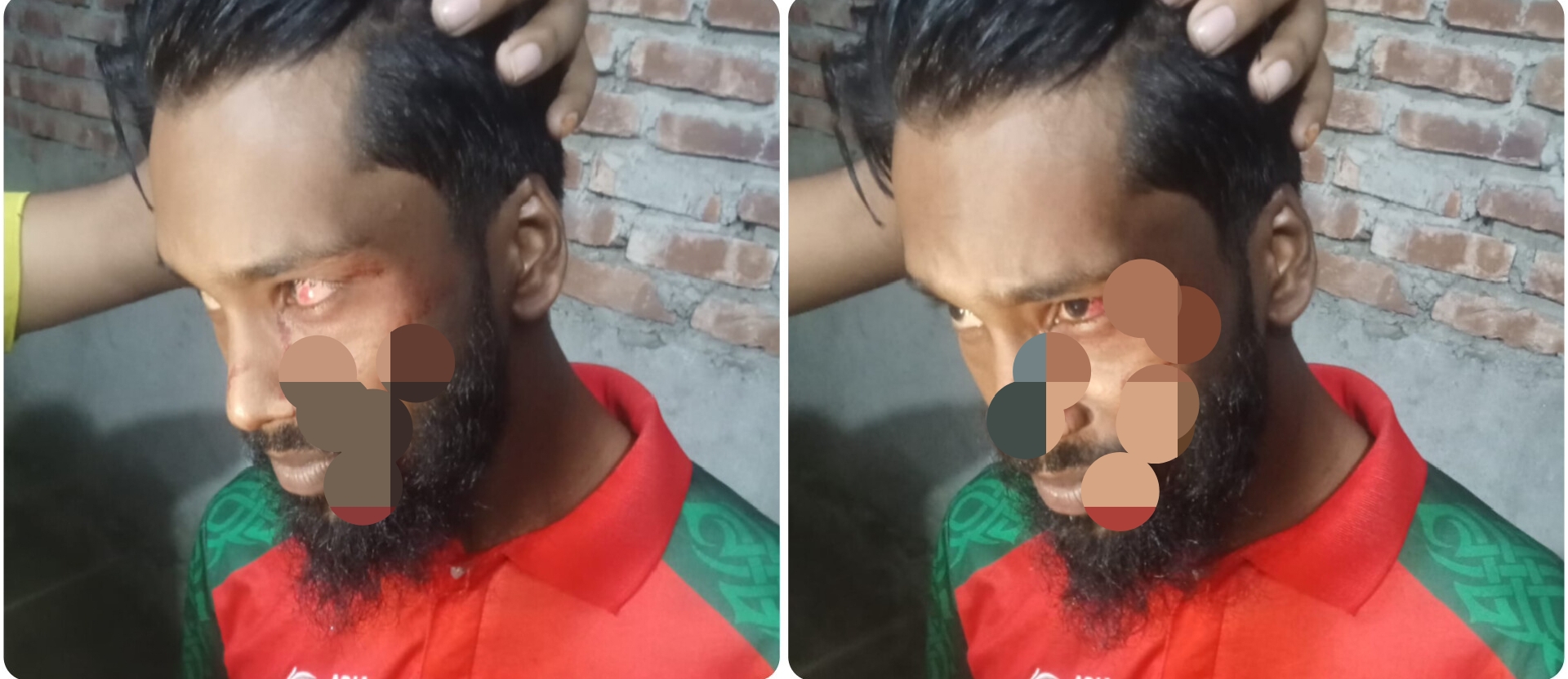 ময়মনসিংহে মাদকবিরোধী কার্যক্রমে যুক্ত দুই যুবকের ওপর হামলা, থানায় অভিযোগ
